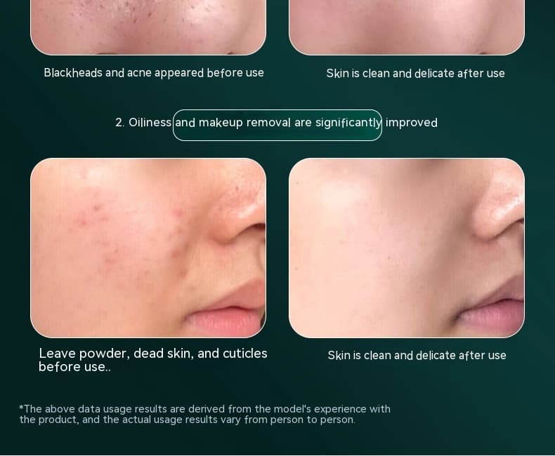 PureGlow - Ultrasonic Facial Skin Cleanser - view 4